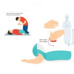 Panduan CPR: 2 Tiupan, 30 Tekanan, Selamatkan Nyawa!